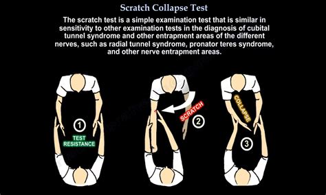 scratch collapse test|long thoracic nerve test.